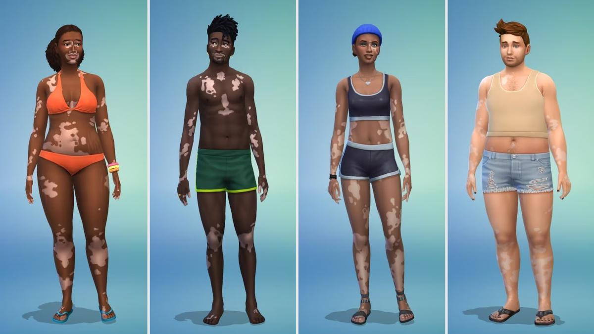 Витилиго. Фото: The Sims 4